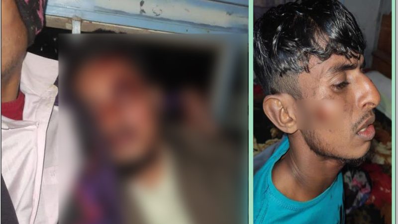 নির্বাচনী সহিংসতা অব্যাহত হিজলায়,সংঘর্ষে আহত ৭