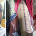 বরিশালে আনসার বাহিনীর গাড়ির ধাক্কায় শিশু নিহত, আহত মা — তিন মাসেও বিচার না পাওয়ার অভিযোগ ভুক্তভোগীদের