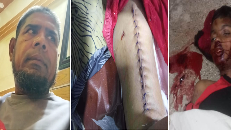 বরিশালে আনসার বাহিনীর গাড়ির ধাক্কায় শিশু নিহত, আহত মা — তিন মাসেও বিচার না পাওয়ার অভিযোগ ভুক্তভোগীদের